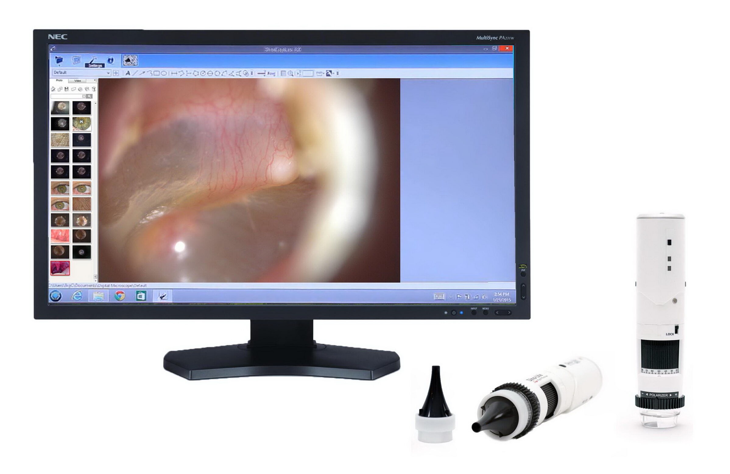 Otoscope includes software, all updates, and tech support