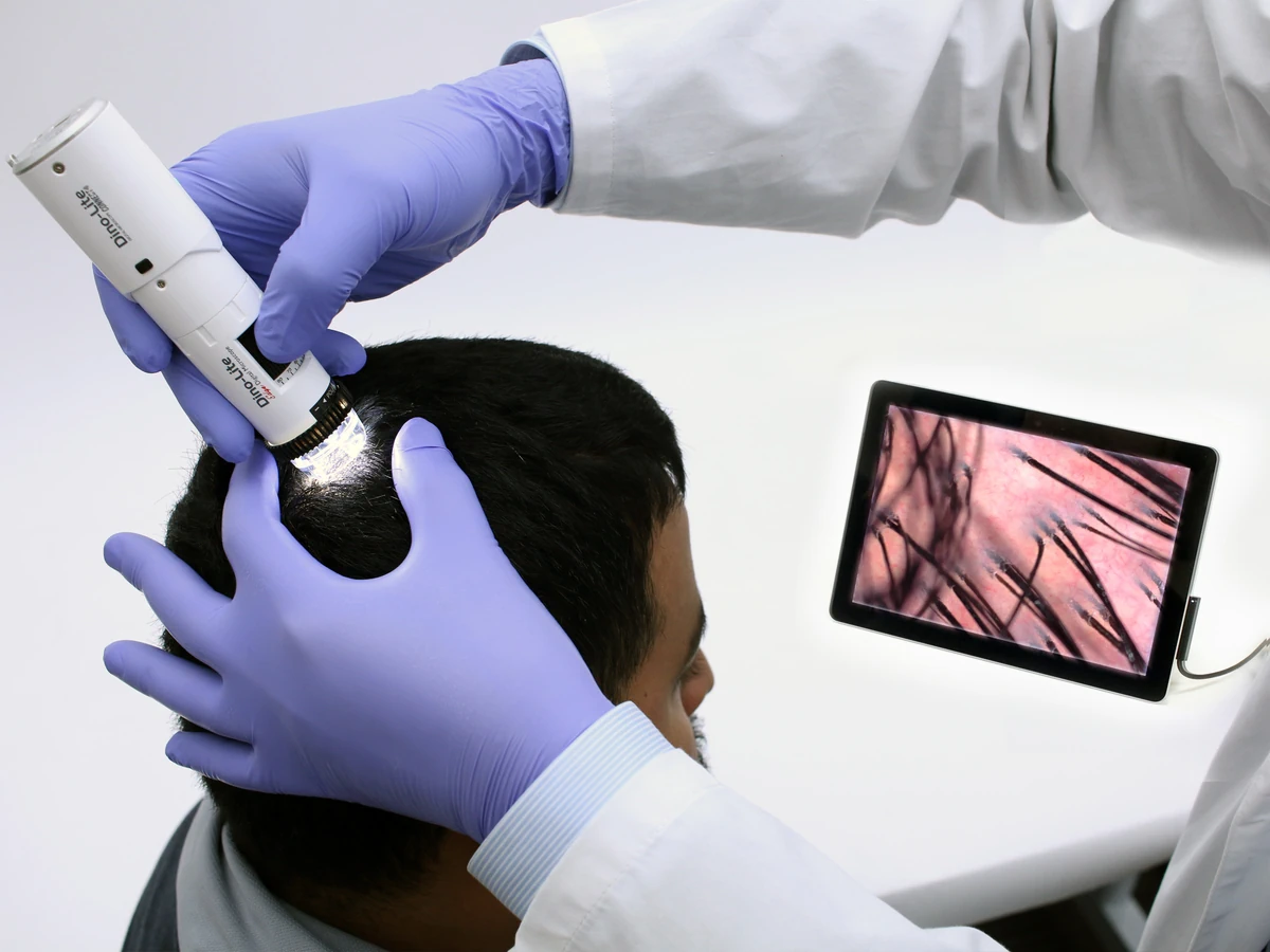 Examine for various hair and scalp conditions such as alopecia areata and seborrheic dermatitis