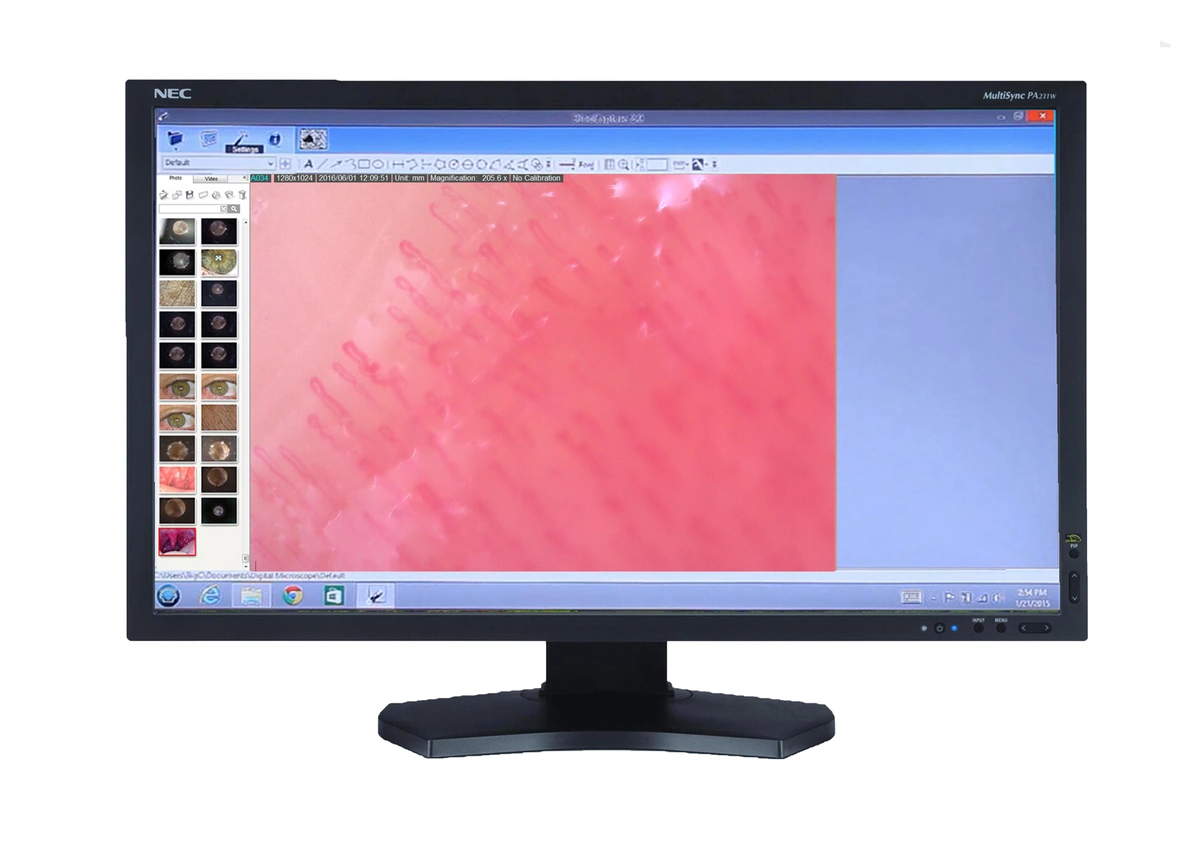 Capillary results viewed in our included software