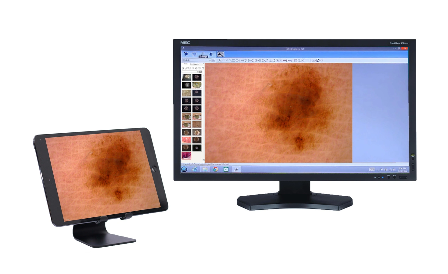 Dermascope results live view in free software or app